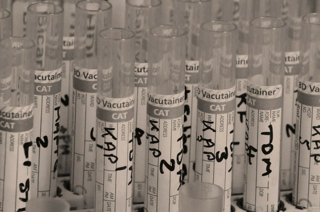 A series of test tubes set up for water testing.